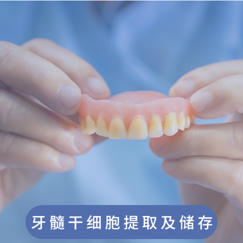 牙髓干细胞提取及储存