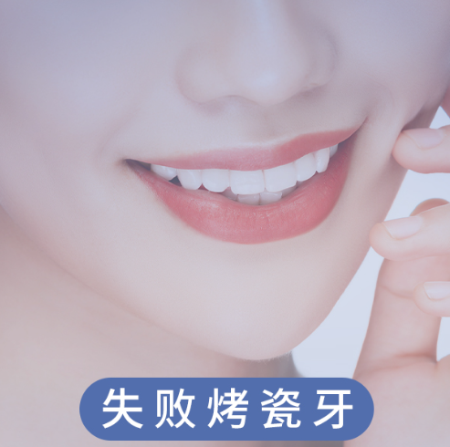 失败烤瓷牙