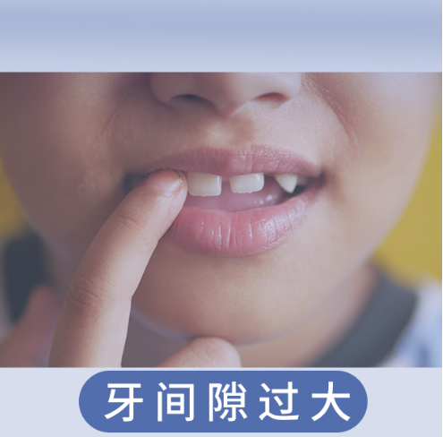 牙间隙过大